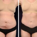 Rediscover Your Confidence After Motherhood