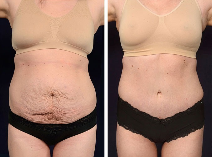 Rediscover Your Confidence After Motherhood