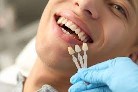 Dental Treatments - Image 3